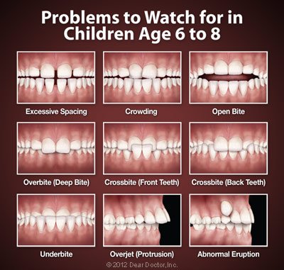 Children's teeth